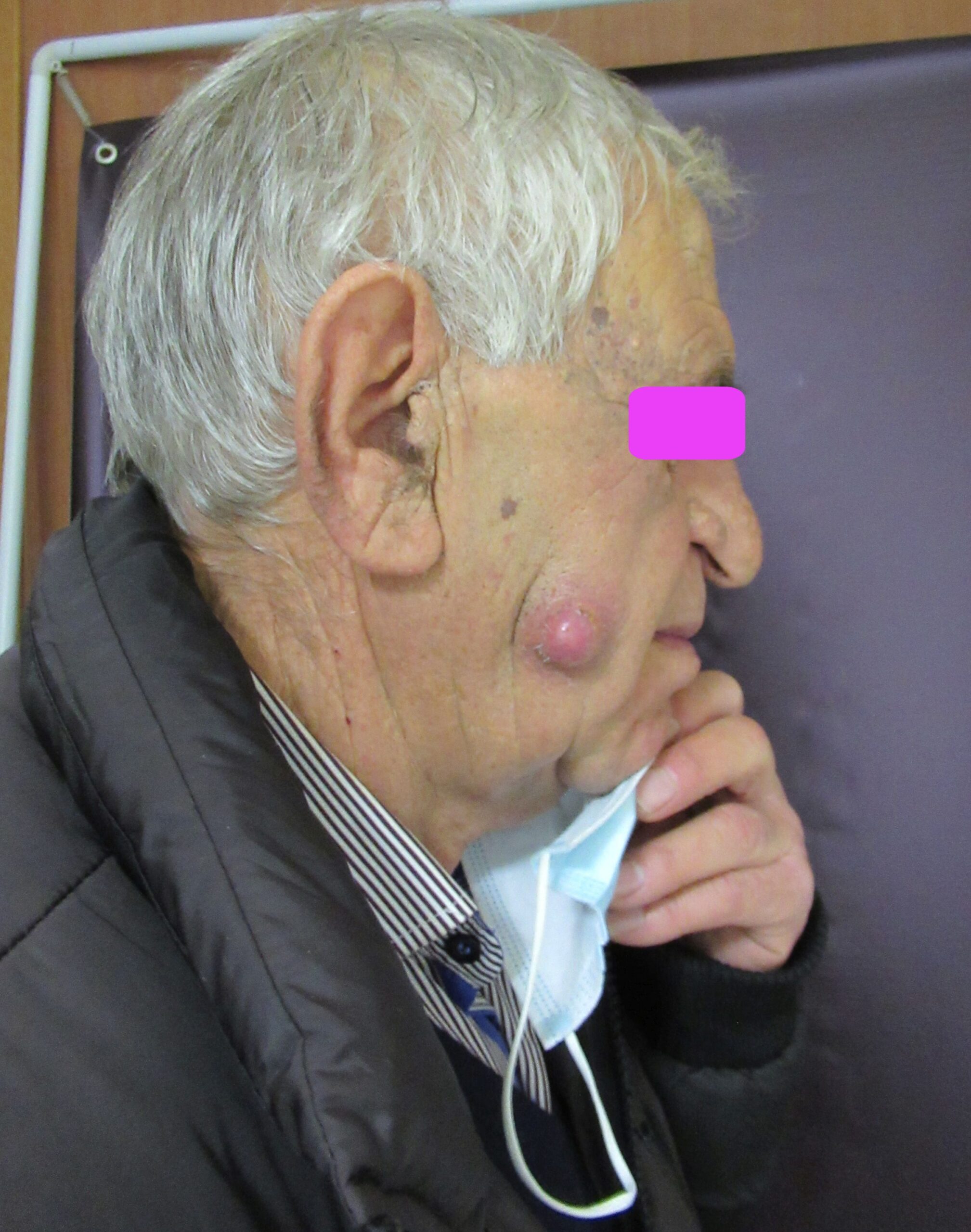 Κύστεις